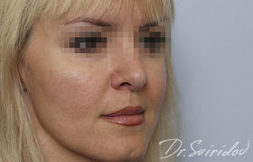 После
