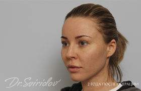 После