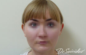 До