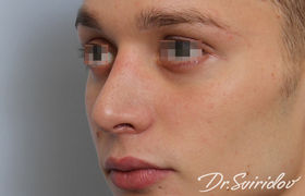 После
