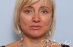 После