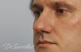 До