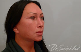 После