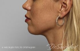 После