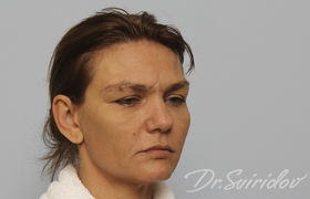 До