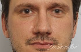 После