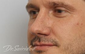 После