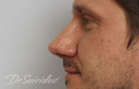 После