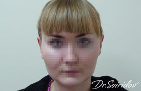 После