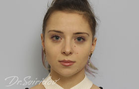После