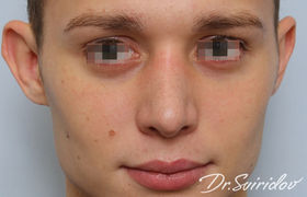 После