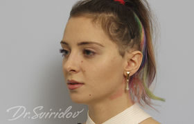 После