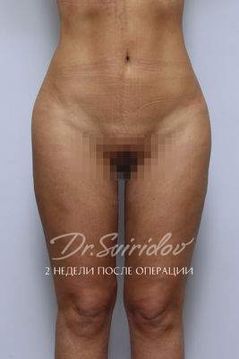 После