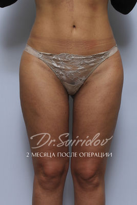 После