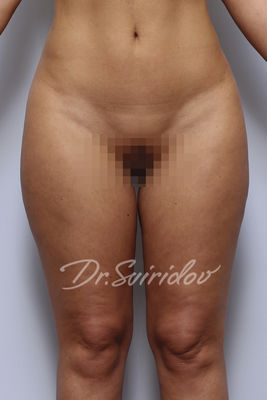 До